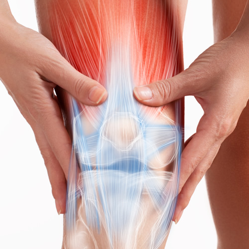 Infiltração do joelho com ácido hialurônico